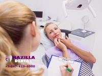 Maxilla Dental image 3